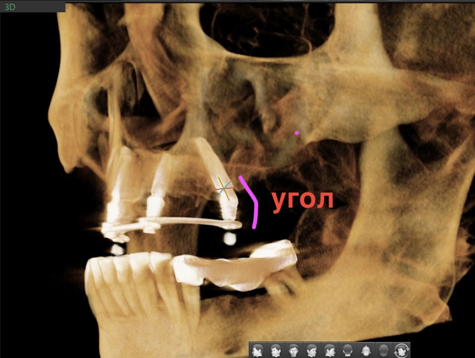 ��� �������� ����������� �������� �� ������� � ����� ����� ���������� �����������