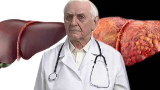 Срочно: 7 тревожных сигналов цирроза печени, которые важно заметить вовремя